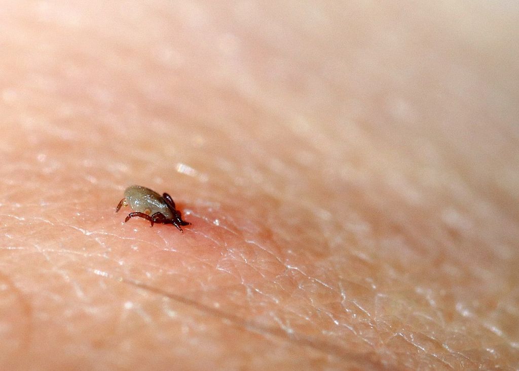 1200px-Castor_Bean_Tick_biting.jpg